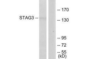 Western blot analysis of extracts from Jurkat cells, using STAG3 antibody. (STAG3 Antikörper  (C-Term))