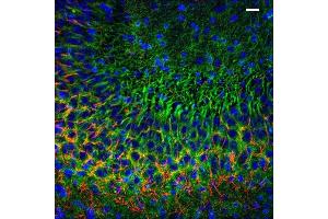 Immunolabeling of postnatal 14 mouse CA3 specifically labeling PSD93 (Cat no (ABIN1304598), 1:400, green) and Ankyrin G(red). (DLG2 Antikörper  (AA 1-852))