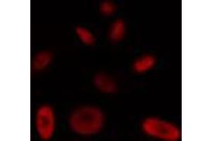 ABIN6272448 staining HT29 by IF/ICC. (Protein Tob1 (TOB1) (Internal Region) Antikörper)