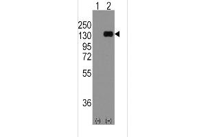 Western Blotting (WB) image for anti-Cadherin 1, Type 1, E-Cadherin (Epithelial) (CDH1) (AA 833-862), (C-Term) antibody (ABIN5534949)