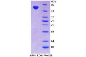 SDS-PAGE (SDS) image for V-Fos FBJ Murine Osteosarcoma Viral Oncogene Homolog (FOS) (AA 6-240) protein (His tag,GST tag) (ABIN2123735)