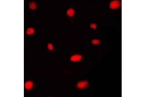 Immunofluorescent analysis of AATF staining in HeLa cells.