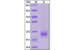 SDS-PAGE (SDS) image for Interleukin 5 (IL5) (AA 20-134) (Active) protein (His tag,AVI tag,Biotin) (ABIN6973128)