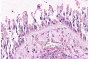Immunohistochemical (Formalin/PFA-fixed paraffin-embedded sections) staining in human nasal mucosa, respiratory epithelium with OR2A4 polyclonal antibody . (OR2A4 Antikörper  (3rd Cytoplasmic Domain))