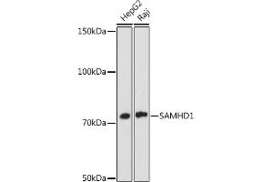 Western blot analysis of extracts of various cell lines, using S antibody (ABIN7270142) at 1:1000 dilution. (SAMHD1 Antikörper)