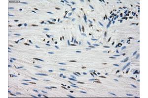 Immunohistochemical staining of paraffin-embedded Kidney tissue using anti-FHmouse monoclonal antibody. (FH Antikörper)