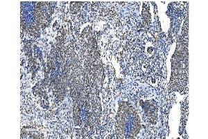 IHC analysis of NRF1 using anti-NRF1 antibody (ABIN7600874). (NRF1 Antikörper  (AA 246-503))
