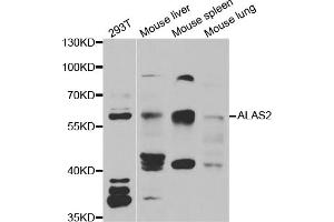 Western blot analysis of extracts of various cell lines, using ALAS2 antibody (ABIN5973907) at 1/1000 dilution. (ALAS2 Antikörper)