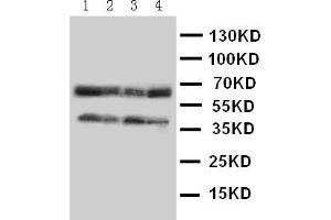 Anti-CCR5 antibody, Western blotting Lane 1: COLO320 Cell Lysate Lane 2: MCF-7 Cell Lysate Lane 3: SMMC Cell Lysate Lane 4: JURKAT Cell Lysate