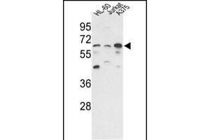 Western blot analysis of hP3CC-E33 (ABIN392895 and ABIN2837849) in HL-60, Jurkat,  cell line lysates (35 μg/lane). (PPP3CC Antikörper  (N-Term))