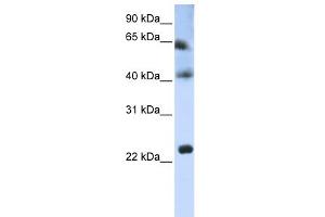 WB Suggested Anti-TSPAN3 Antibody Titration:  0. (Tetraspanin 3 Antikörper  (Middle Region))