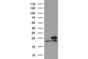 Image no. 1 for anti-NADH Dehydrogenase (Ubiquinone) 1 beta Subcomplex, 10, 22kDa (NDUFB10) antibody (ABIN1499670) (NDUFB10 Antikörper)