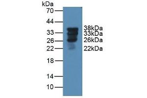 Detection of SFTPA1 in Rat Lung Tissue using Polyclonal Antibody to Pulmonary Surfactant Associated Protein A1 (SFTPA1) (Surfactant Protein A1 Antikörper  (AA 21-248))