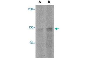 Western blot analysis of ANO2 in rat brain tissue lysate with ANO2 polyclonal antibody  at (A) 1 and (B) 2 ug/mL . (Anoctamin 2 Antikörper  (N-Term))