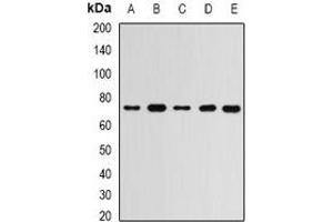 Western blot analysis of RBBP5 expression in MCF7 (A), Hela (B), mouse spleen (C), mouse brain (D), rat liver (E) whole cell lysates. (RBBP5 Antikörper)