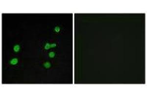 Immunofluorescence analysis of MCF-7 cells, using p97 MAPK antibody. (MAPK6 Antikörper)