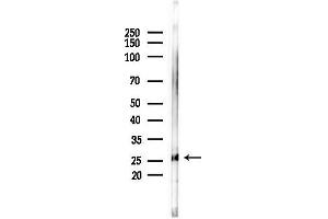 anti-Noggin (NOG) (Internal Region) antibody