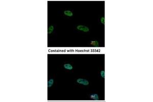 ICC/IF Image Immunofluorescence analysis of paraformaldehyde-fixed HeLa, using TRIP15, antibody at 1:500 dilution. (COPS2 Antikörper  (C-Term))