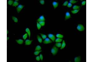 Immunofluorescence staining of Hela cells with ABIN7169254 at 1:166, counter-stained with DAPI. (PPP2R5E Antikörper  (Regulatory Subunit))