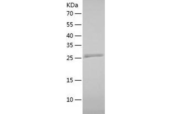 DDAH1 Protein (AA 1-285) (His tag)