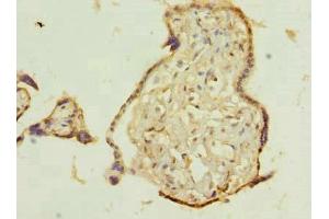 Immunohistochemistry of paraffin-embedded human placenta tissue using ABIN7173035 at dilution of 1:100 (TMEM115 Antikörper  (AA 187-351))