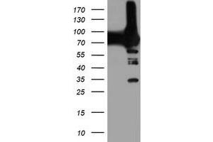 Western Blotting (WB) image for anti-phosphofructokinase, Platelet (PFKP) antibody (ABIN1500166) (PFKP Antikörper)