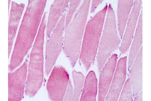 Immunohistochemistry (IHC) image for anti-NADH Dehydrogenase (Ubiquinone) 1 alpha Subcomplex, Assembly Factor 2 (NDUFAF2) (AA 22-71) antibody (ABIN6749794)