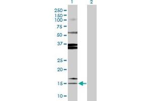 Western Blot analysis of SPINK1 expression in transfected 293T cell line by SPINK1 MaxPab polyclonal antibody. (SPINK1 Antikörper  (AA 1-79))