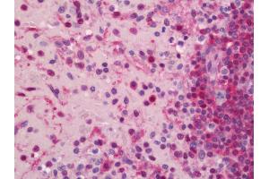 anti-Chromodomain Helicase DNA Binding Protein 1 (CHD1) (AA 1177-1272) antibody