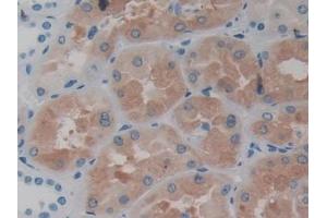 DAB staining on IHC-P; Samples: Human Kidney Tissue (ASS1 Antikörper  (AA 1-412))