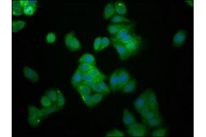Immunofluorescence staining of HepG2 cells with ABIN7174451 at 1:166, counter-stained with DAPI. (UBE2G1 Antikörper  (AA 2-170))