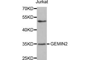 Western blot analysis of extracts of Jurkat cells, using GEMIN2 antibody. (SIP1 Antikörper)