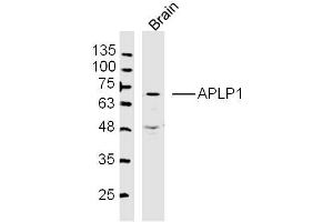 Mouse Brain lysates probed with APLP1 Polyclonal Antibody, Unconjugated  at 1:300 dilution and 4˚C overnight incubation. (APLP1 Antikörper  (AA 1-100))