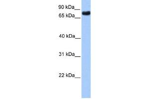 WB Suggested Anti-TLE2 Antibody Titration:  0. (TLE2 Antikörper  (N-Term))
