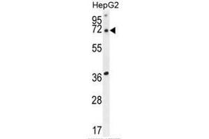 ACOT11 Antibody (C-term) western blot analysis in HepG2 cell line lysates (35 µg/lane). (ACOT11 Antikörper  (C-Term))