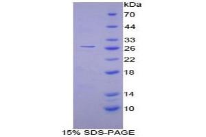 SDS-PAGE analysis of Human CAMK2g Protein. (CAMKII gamma Protein)