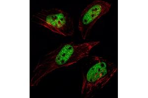 Fluorescent image of Hela cell stained with SUMO1 Antibody (N-term E67) (ABIN1882137 and ABIN2845494)/SH030609A. (SUMO1 Antikörper  (N-Term))