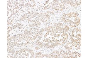 Immunohistochemistry (IHC) image for anti-Histone H3 (H3) (C-Term) antibody (ABIN7455227) (Histone 3 Antikörper  (C-Term))