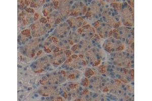 Immunohistochemistry (IHC) image for anti-Membrane Protein, Palmitoylated 3 (MAGUK P55 Subfamily Member 3) (MPP3) (AA 385-570) antibody (ABIN5013921)