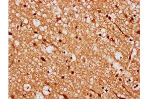 IHC image of ABIN7168370 diluted at 1:300 and staining in paraffin-embedded human brain tissue performed on a Leica BondTM system. (MEX3A Antikörper  (AA 416-466))