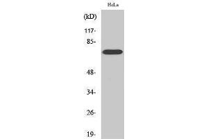 Western Blotting (WB) image for anti-V-Raf-1 Murine Leukemia Viral Oncogene Homolog 1 (RAF1) (Thr56) antibody (ABIN3177115) (RAF1 Antikörper  (Thr56))