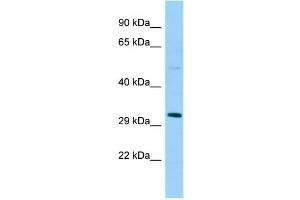 Western Blotting (WB) image for anti-SplA/ryanodine Receptor Domain and SOCS Box Containing 1 (SPSB1) (Middle Region) antibody (ABIN2774457)