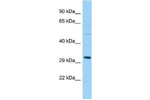 WB Suggested Anti-SPSB1 Antibody Titration: 1. (SPSB1 Antikörper  (Middle Region))
