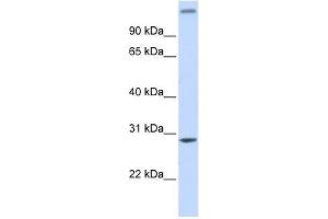 ALKBH2 antibody used at 1 ug/ml to detect target protein. (ALKBH2 Antikörper)