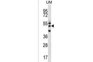 RMD2 Antibody (Center) (ABIN1538003 and ABIN2849325) western blot analysis in uterus tumor cell line lysates (35 μg/lane). (FAM82A1 Antikörper  (AA 188-216))