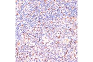 Immunohistochemistry of paraffin-embedded human tonsil using VHL antibody (ABIN3020967, ABIN3020968, ABIN3020969 and ABIN6213828) at dilution of 1:200 (40x lens). (VHL Antikörper  (AA 1-172))