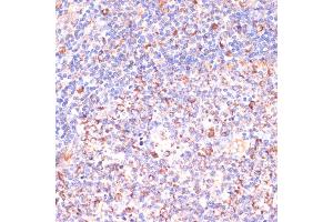 Immunohistochemistry of paraffin-embedded human tonsil using VHL antibody (ABIN3020967, ABIN3020968, ABIN3020969 and ABIN6213828) at dilution of 1:200 (40x lens).