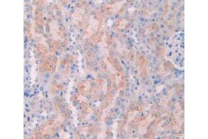 IHC-P analysis of Mouse Kidney Tissue, with DAB staining. (CA7 Antikörper  (AA 58-217))