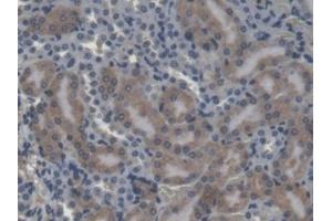 IHC-P analysis of Mouse Kidney Tissue, with DAB staining. (CES1 Antikörper  (AA 31-286))