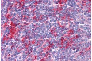 Human Tonsil: Formalin-Fixed, Paraffin-Embedded (FFPE) (KLHL25 Antikörper  (Internal Region))